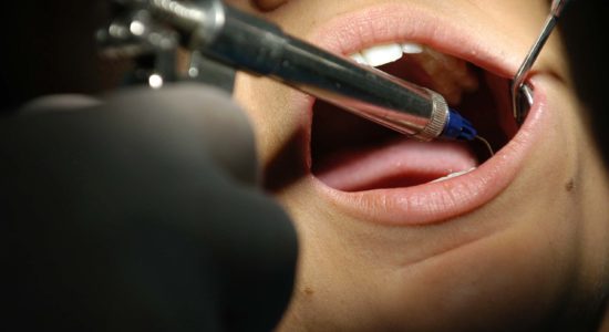 Prevenire le spese dentistiche e risparmiare, come fare