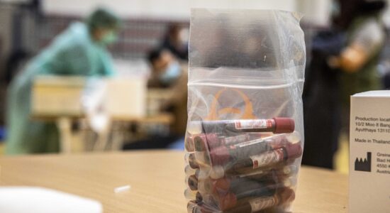 I metodi veloci e infallibili per togliere le macchie di sangue dai tessuti