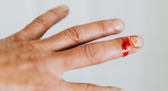 sangue