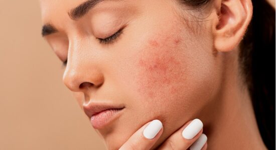 skincare