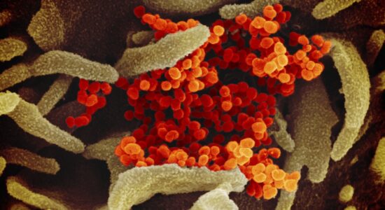 virus