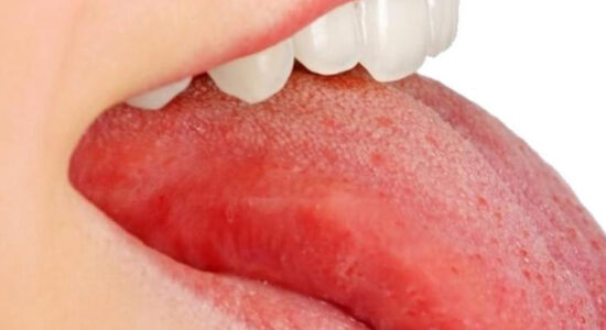 il colore della lingua può dire molto sul nostro stato di salute