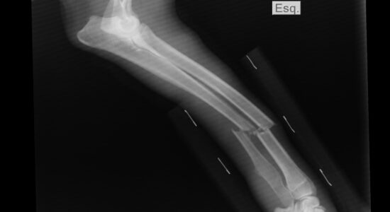 radiografie