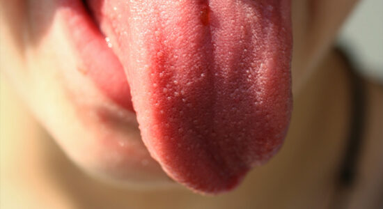 lingua