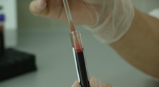 analisi del sangue