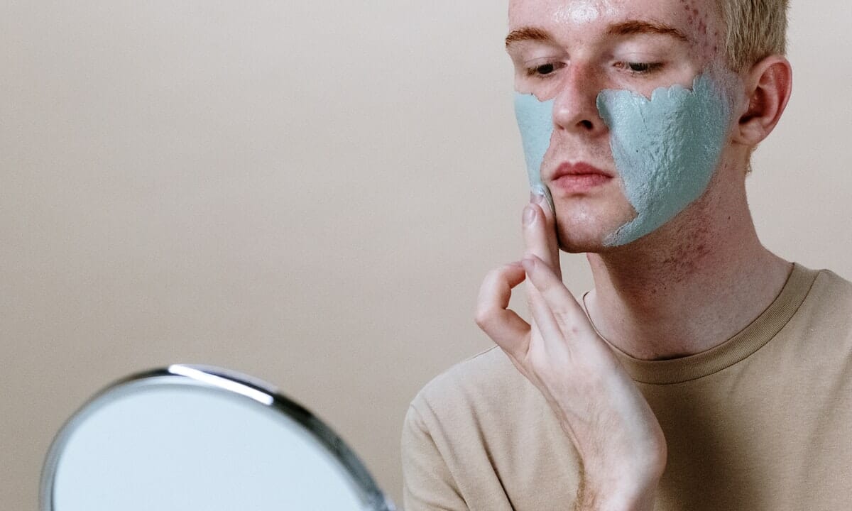 La crema a base di artemisia lenire rossori e pruriti causati dall’acne