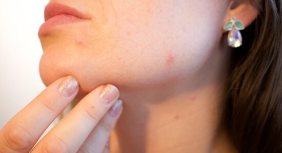 Vuoi una pelle più liscia e senza brufoli?