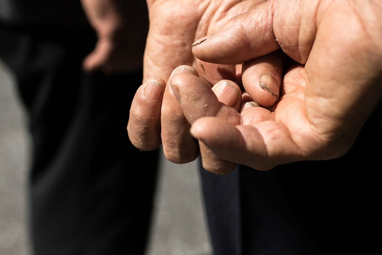 malattie neurodegenerative come l’Alzheimer e il Parkinson