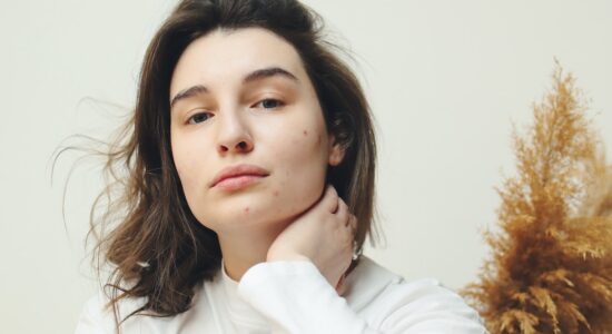 pelle con couperose o rosacea