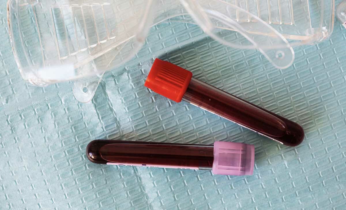 Attraverso le analisi del sangue si può risalire ai livelli di colesterolo totale, LDL e HDL