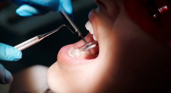 Come proteggere i denti dagli zuccheri