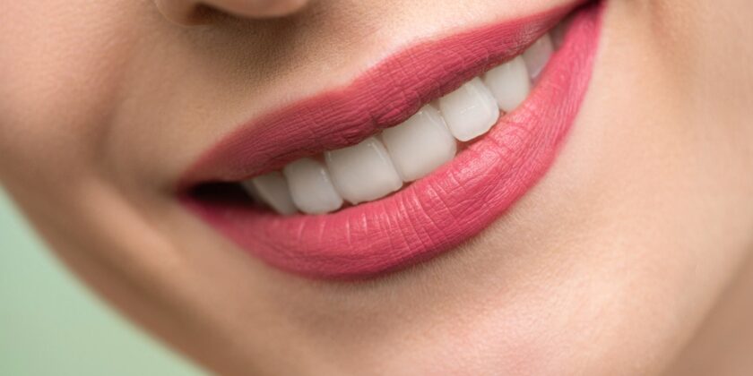 Meglio pulizia dei denti professionale o sbiancamento