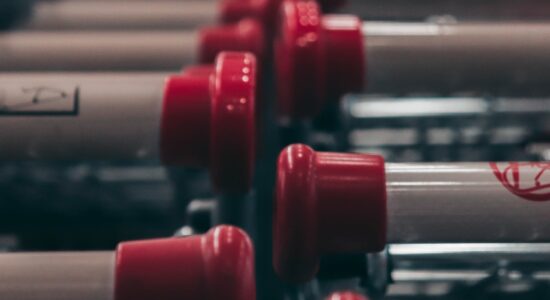 Al supermercato occhio alla maniglia del carrello