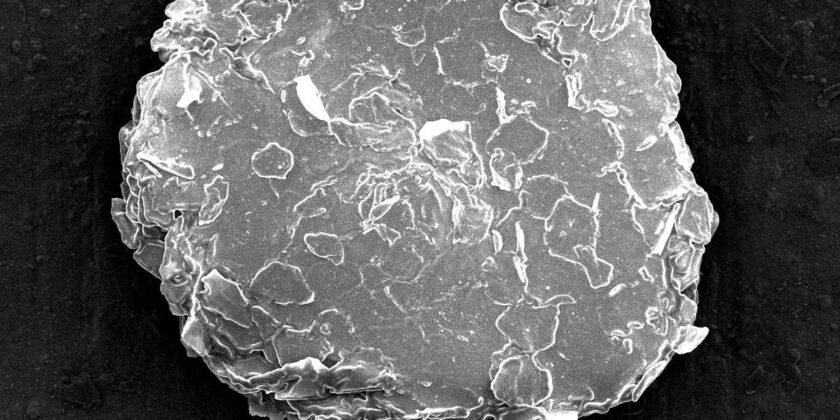Foto microscopica della forfora