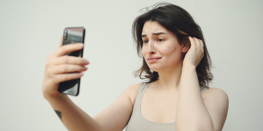 Come combattere l’acne