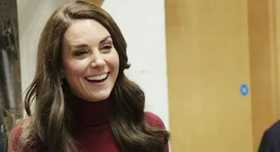 Combattere le rughe del viso come fa Kate Middleton