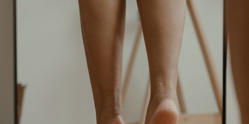 Cellulite e smagliature con l’estate alle porte-proiezionidiborsa.it
