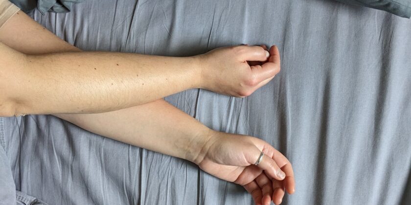 Cosa indossare se hai le braccia grandi per farle sembrare più magre