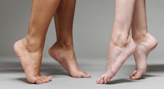 Mai più talloni screpolati e secchi con questi facili rimedi