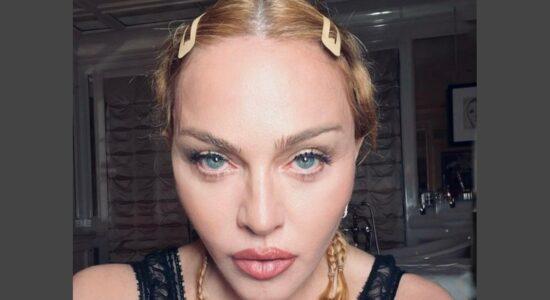 Quale trattamento estetico segreto usa Madonna per mantenersi giovane