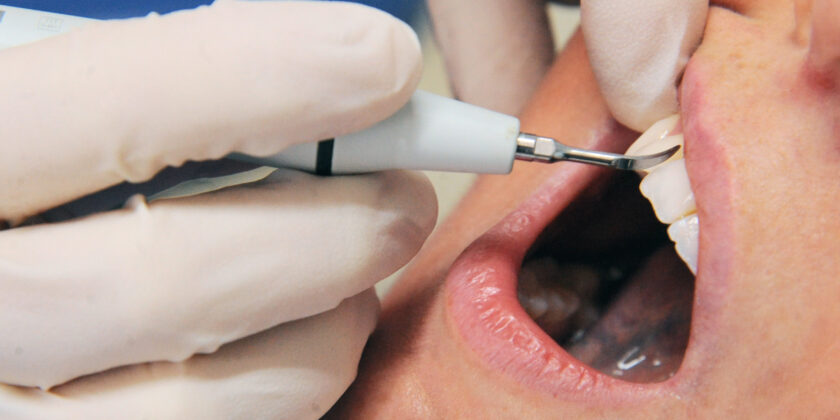 Curarsi i denti in Italia-proiezionidiborsa.it