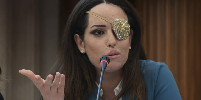 Gessica Notaro-Foto da imagoeconomica